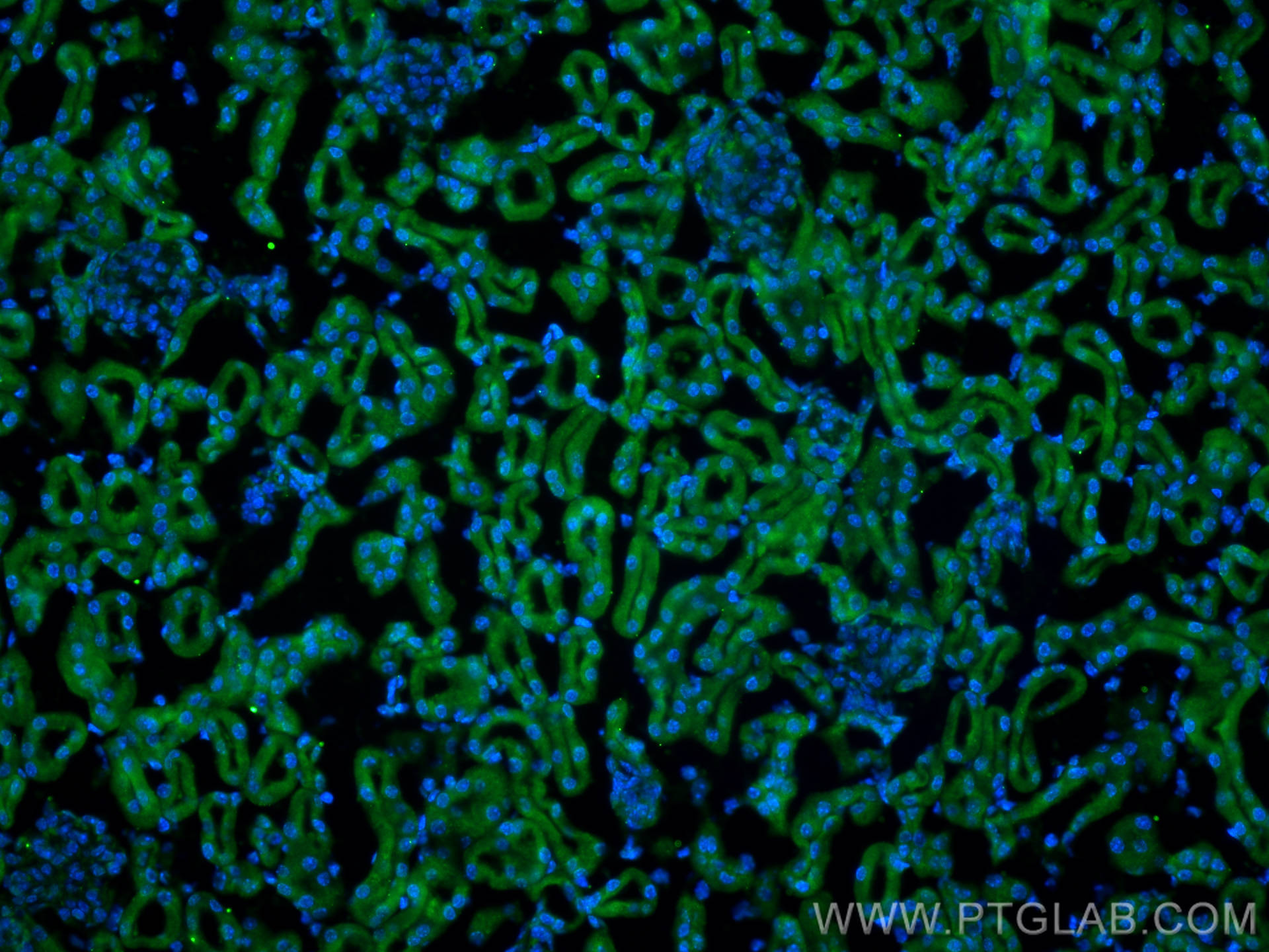 IF Staining of mouse kidney using 12869-1-AP