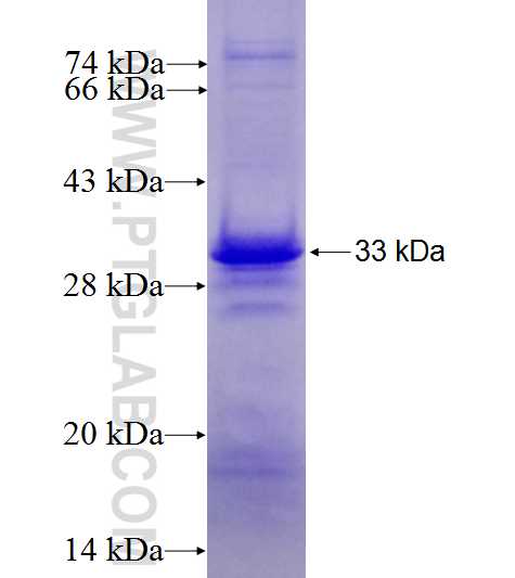 UGCGL2 fusion protein Ag4356 SDS-PAGE