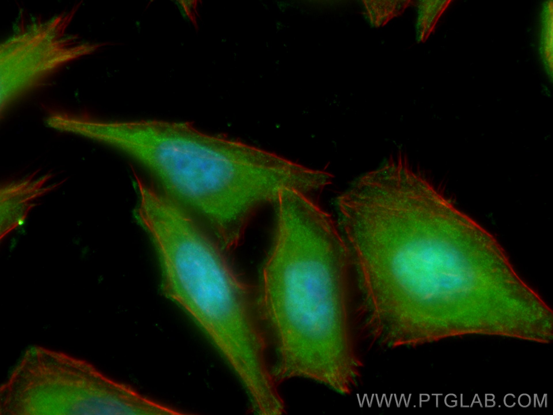 IF Staining of HepG2 using 67360-1-Ig (same clone as 67360-1-PBS)