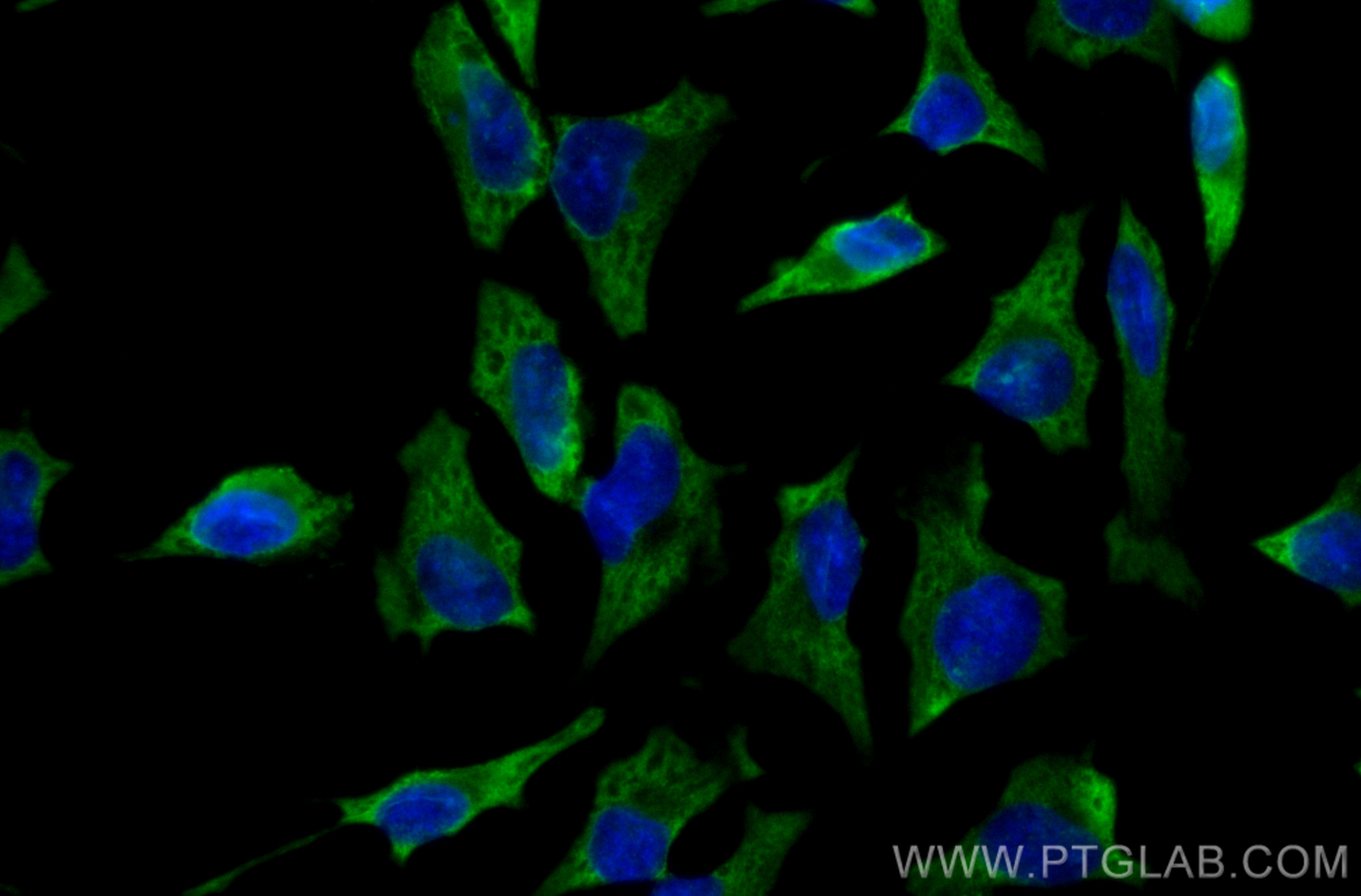 IF Staining of HeLa using CL488-67360