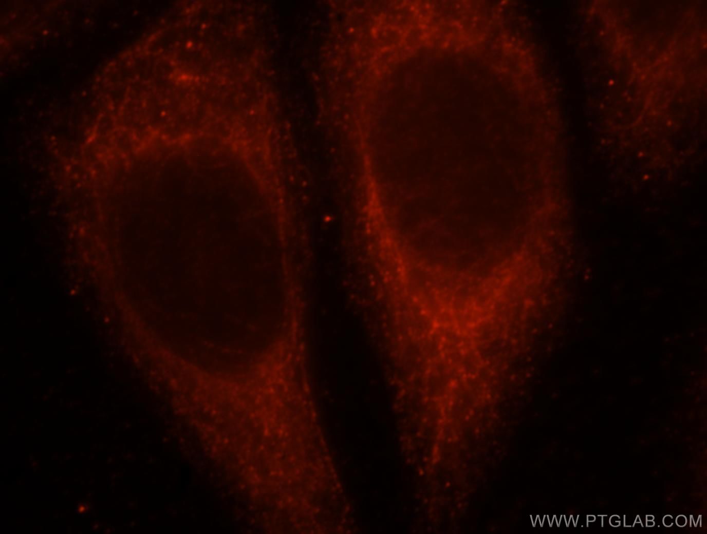 IF Staining of HepG2 using 16661-1-AP