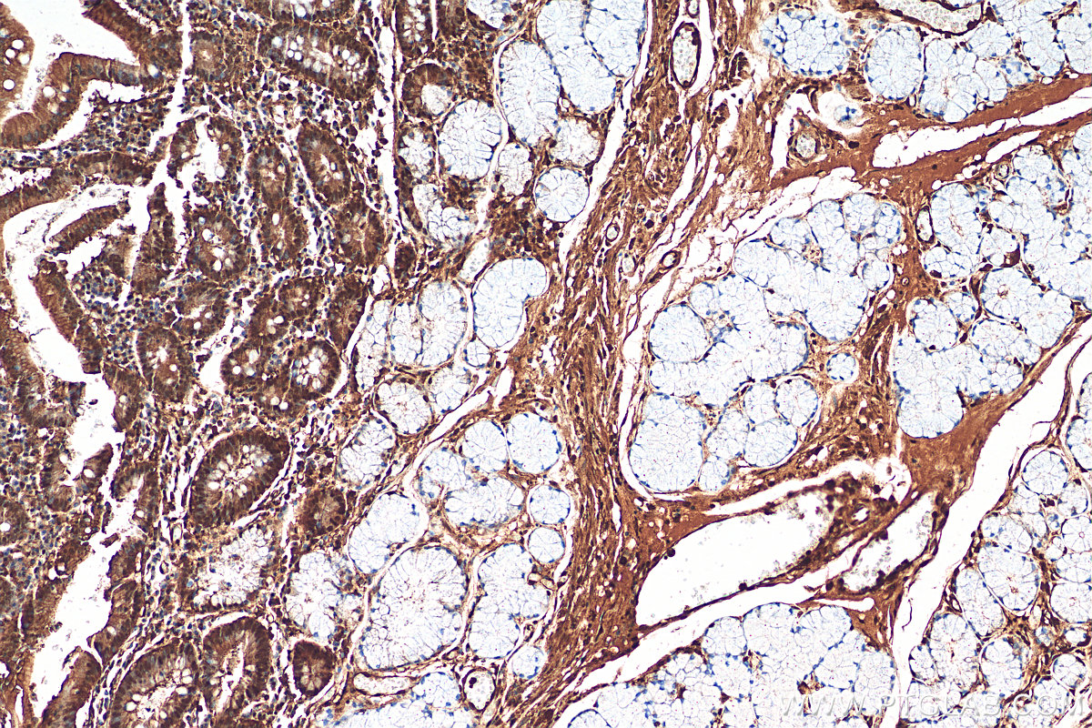 IHC staining of human stomach using 11624-1-AP