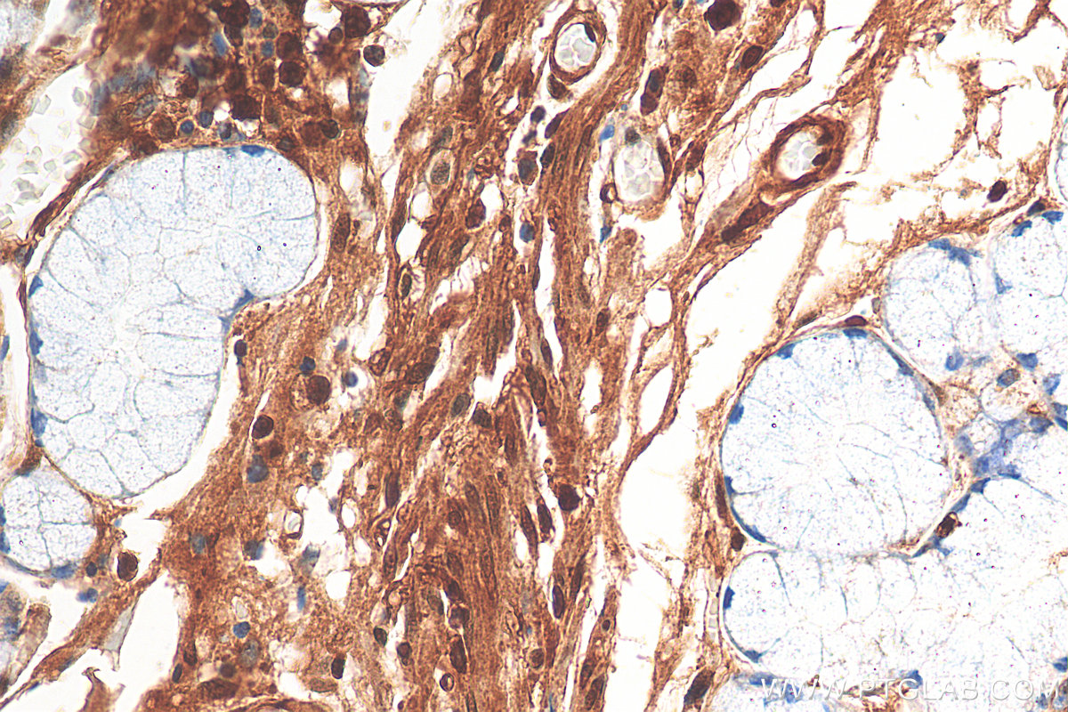 IHC staining of human stomach using 11624-1-AP