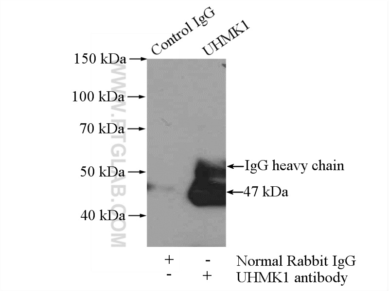 IP experiment of mouse brain using 11624-1-AP