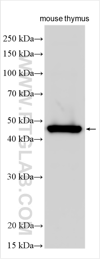 WB analysis of mouse thymus using 11624-1-AP