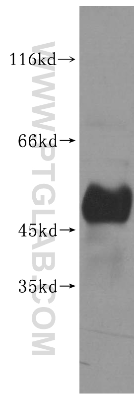 WB analysis of mouse thymus using 11624-1-AP