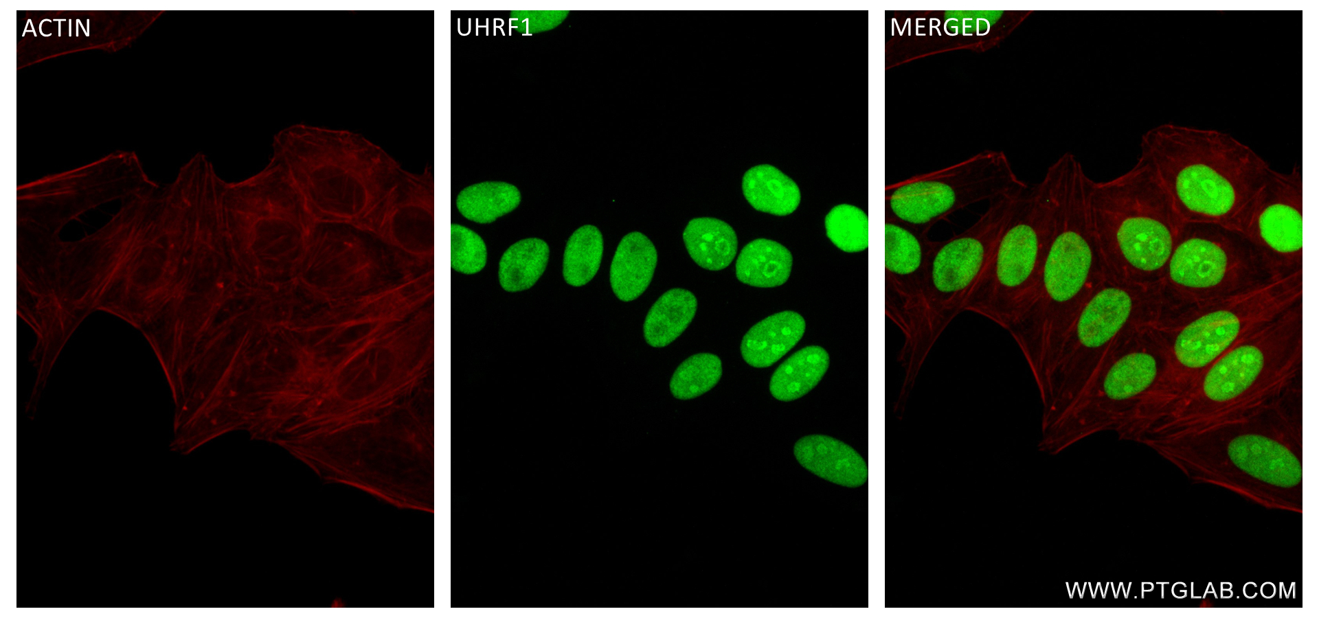 IF Staining of HepG2 using 84489-4-RR (same clone as 84489-4-PBS)