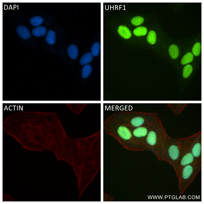 IF Staining of HepG2 using 84489-5-RR