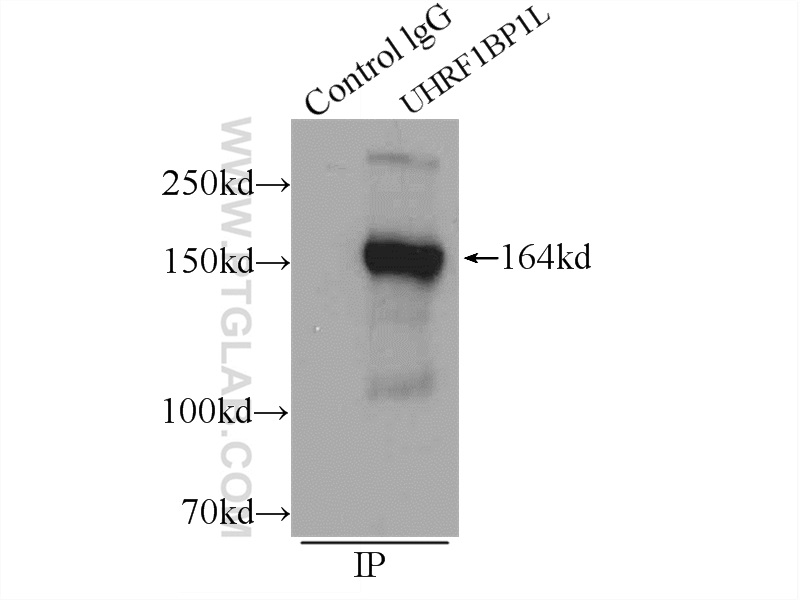 IP experiment of mouse brain using 25121-1-AP