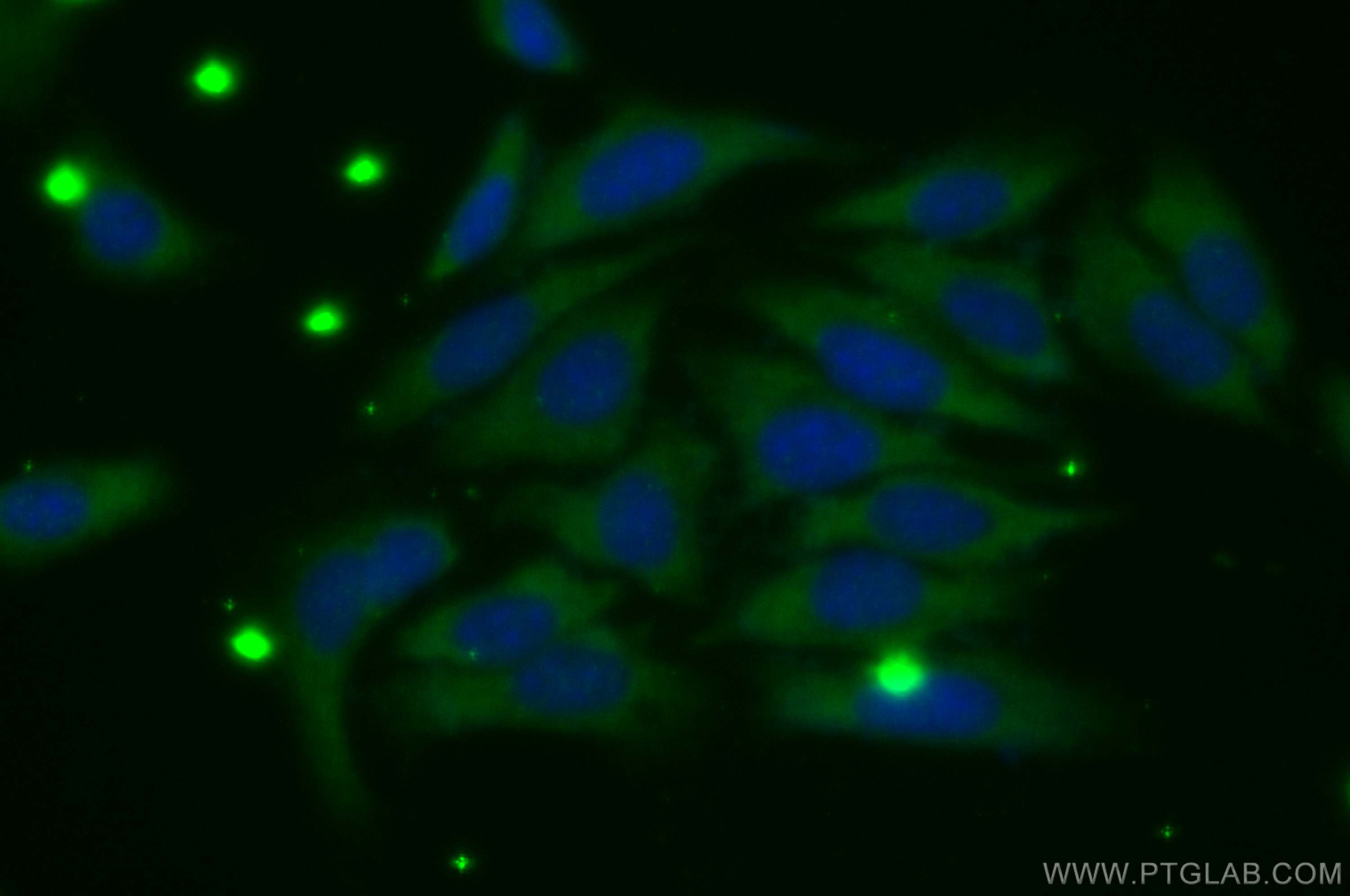 IF Staining of HepG2 using 27352-1-AP