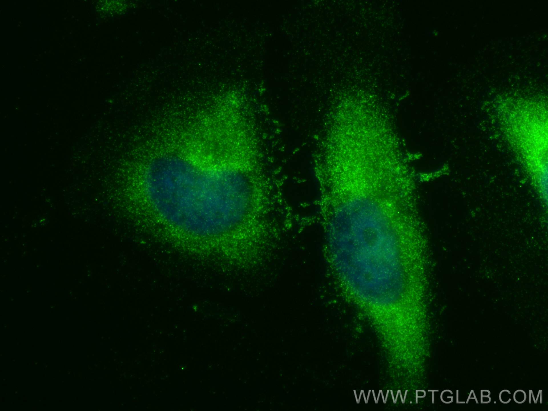 IF Staining of HeLa using 27352-1-AP