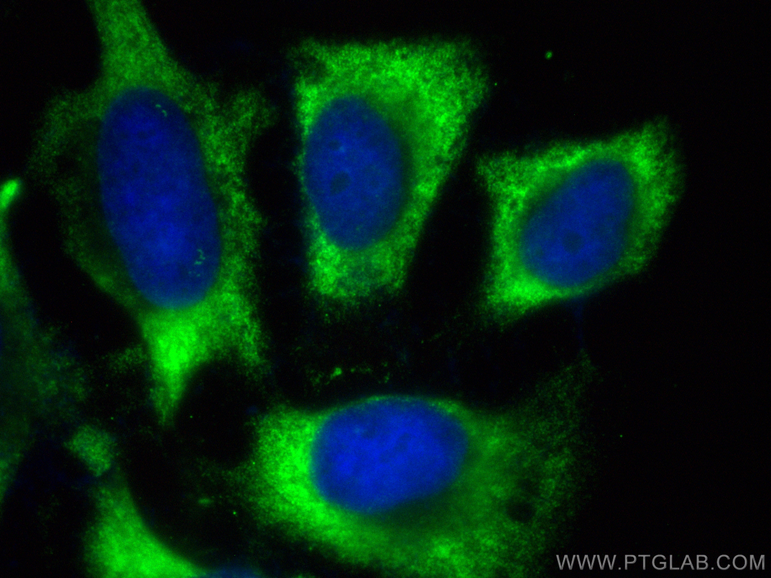 IF Staining of HeLa using CL488-29005