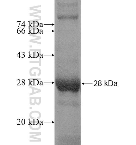 ULK3 fusion protein Ag15094 SDS-PAGE