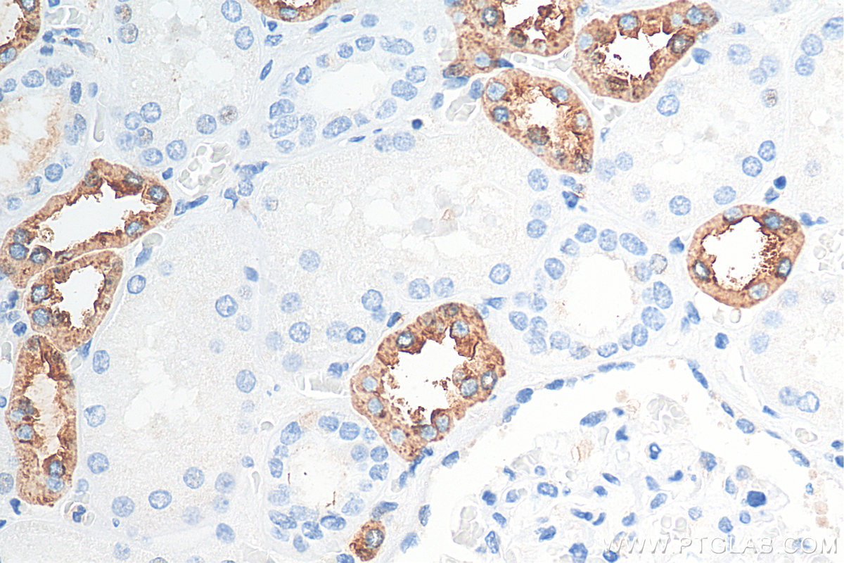 IHC staining of human kidney using 29975-1-AP (same clone as 29975-1-PBS)