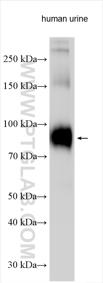 WB analysis of human urine using 29975-1-AP (same clone as 29975-1-PBS)