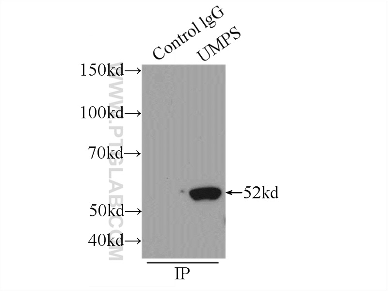 IP experiment of HEK-293 using 14830-1-AP