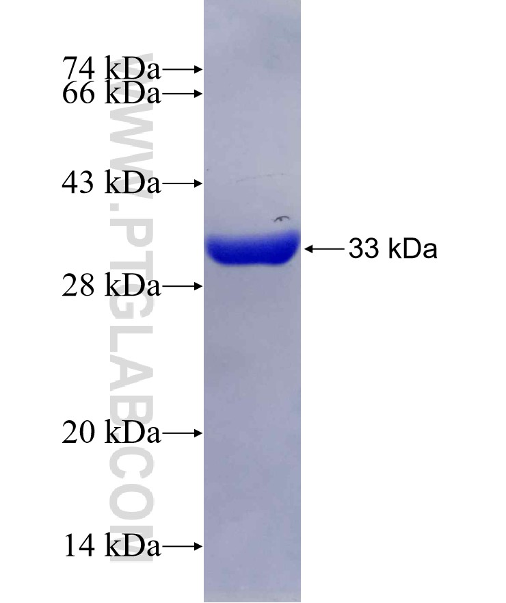 UMPS fusion protein Ag6962 SDS-PAGE