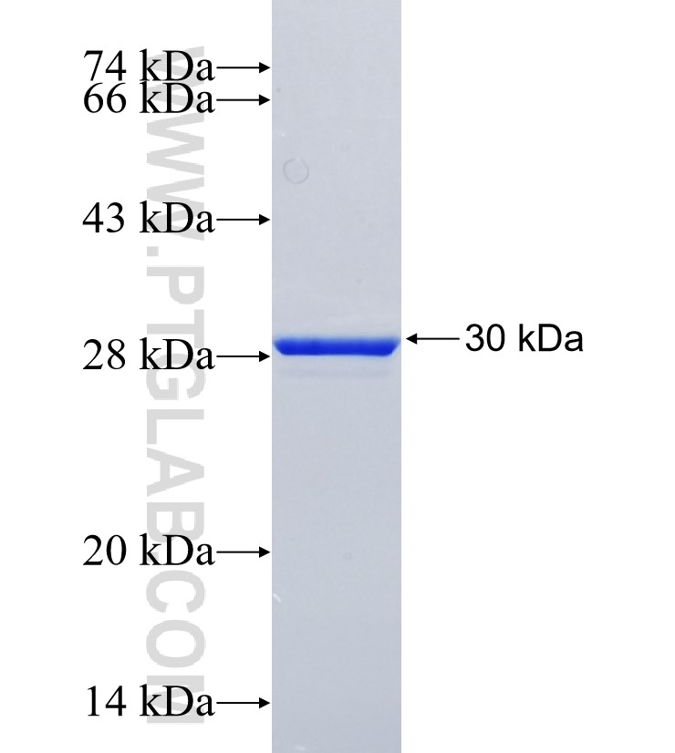 UNC119B fusion protein Ag24916 SDS-PAGE