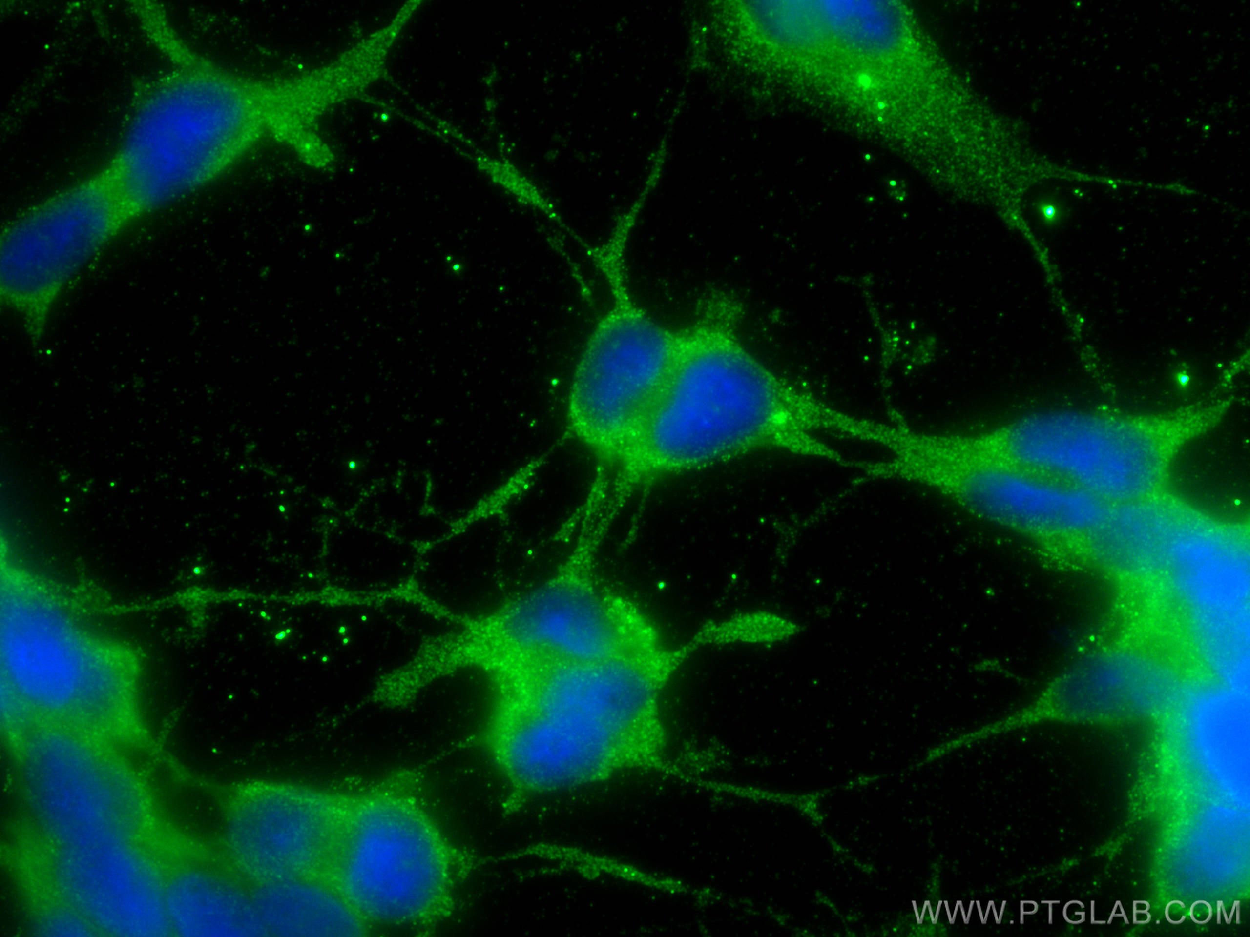 IF Staining of SH-SY5Y using 68483-1-Ig (same clone as 68483-1-PBS)