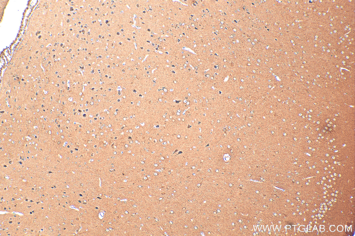 IHC staining of mouse brain using 68483-1-Ig (same clone as 68483-1-PBS)