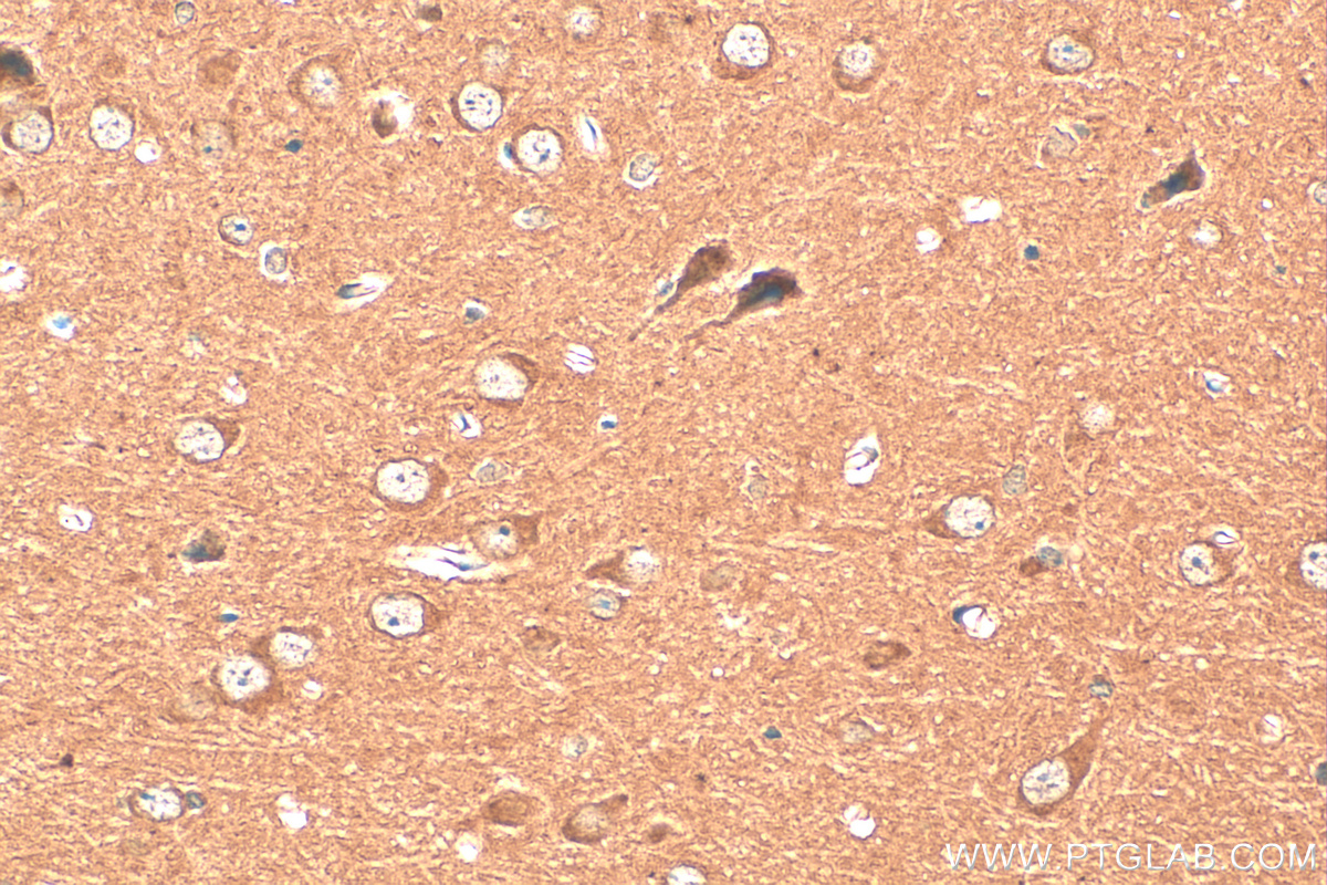 IHC staining of mouse brain using 68483-1-Ig