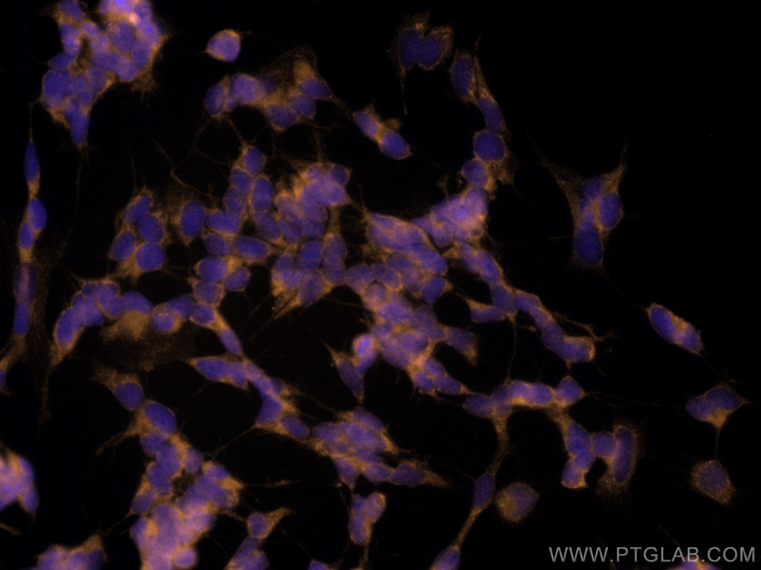 IF Staining of SH-SY5Y using CL555-68483