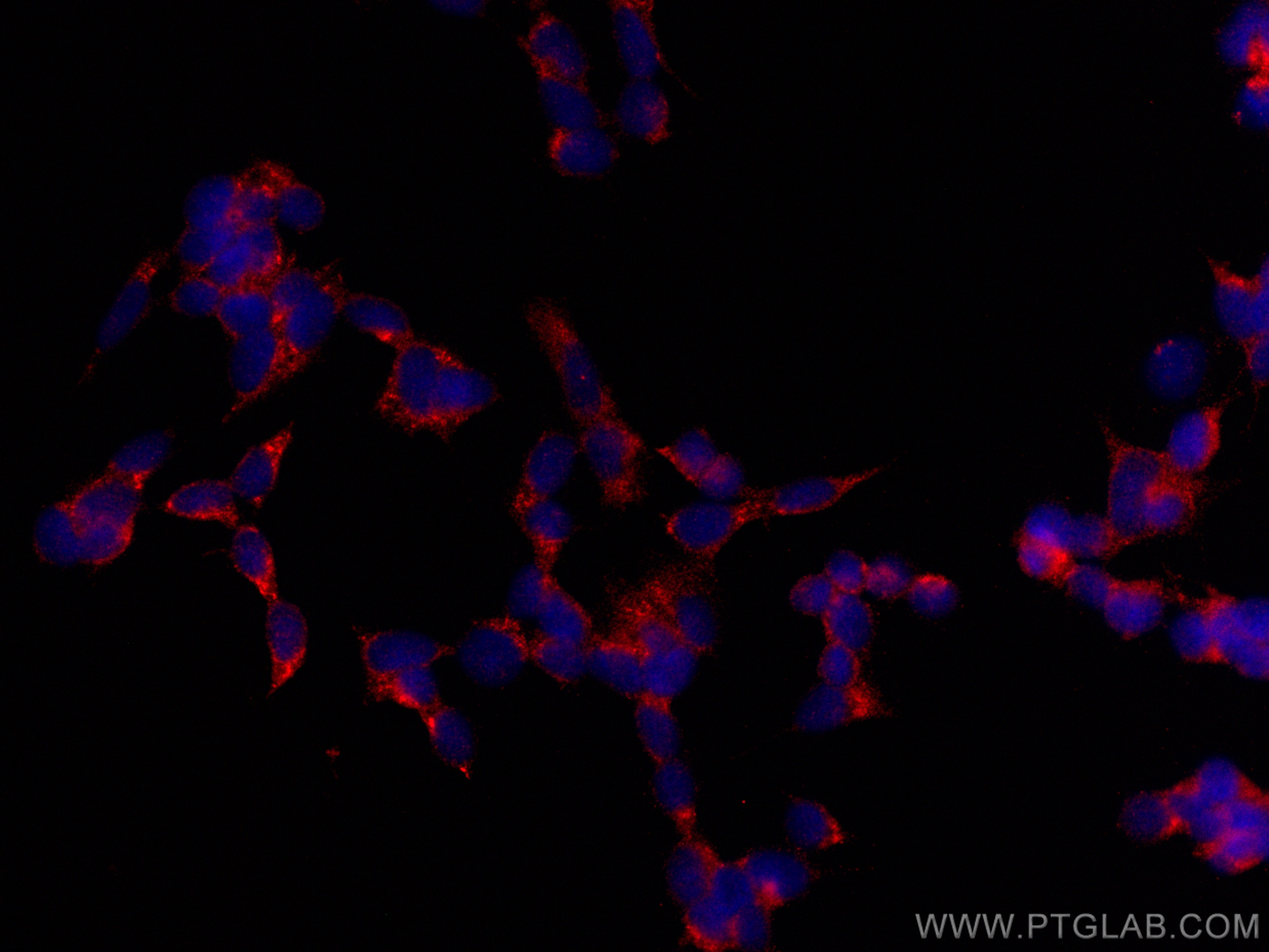 IF Staining of SH-SY5Y using CL594-68483