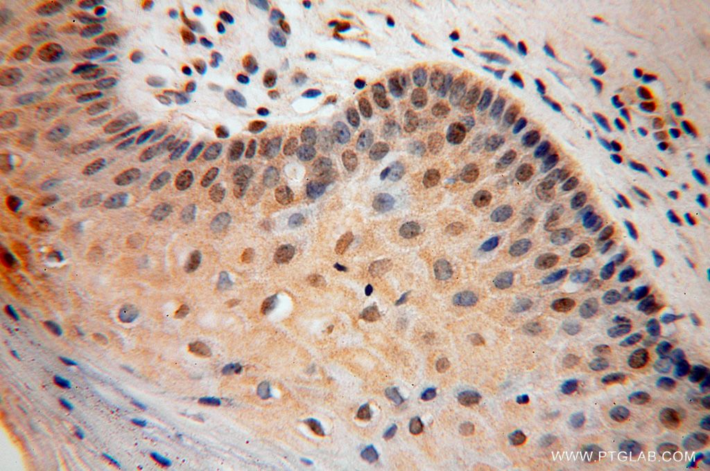 IHC staining of human cervix using 15479-1-AP