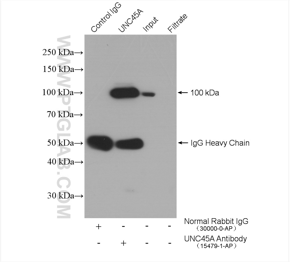 IP experiment of HeLa using 15479-1-AP