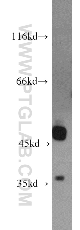 WB analysis of HeLa using 15000-1-AP