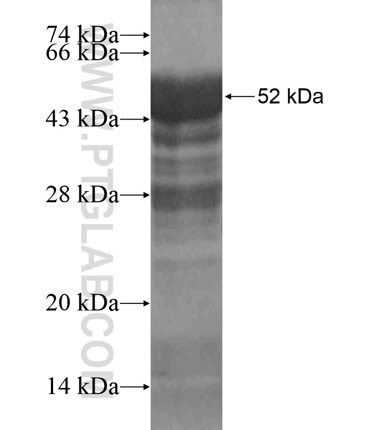 UPF3B fusion protein Ag18568 SDS-PAGE
