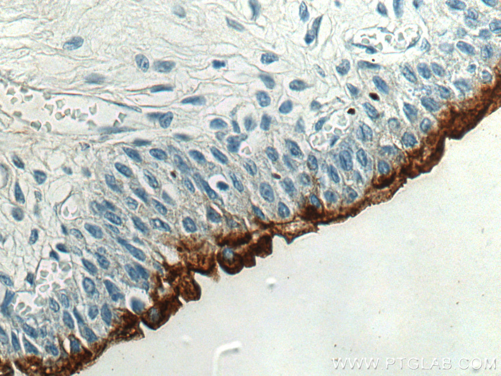 IHC staining of human bladder using 25275-1-AP