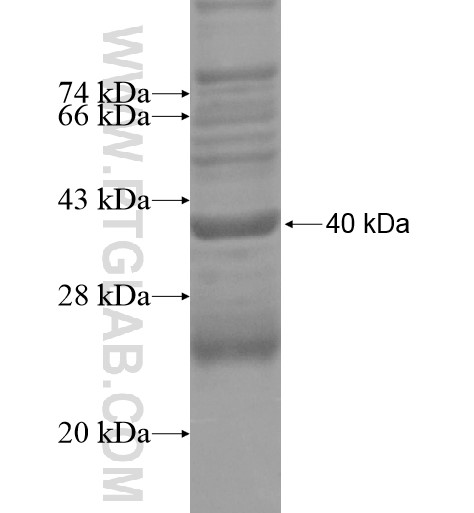 UPK2 fusion protein Ag15694 SDS-PAGE