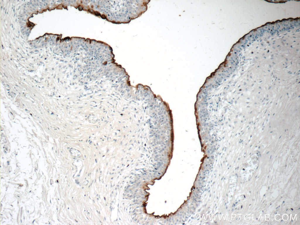 IHC staining of human bladder using 19733-1-AP