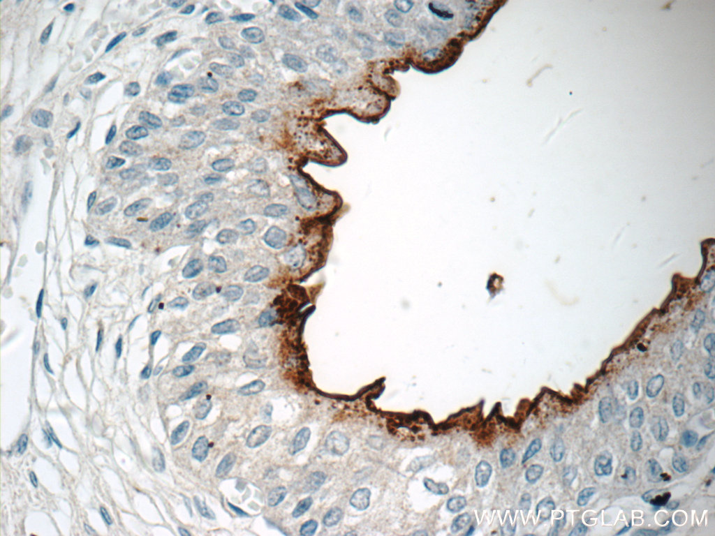 IHC staining of human bladder using 19733-1-AP