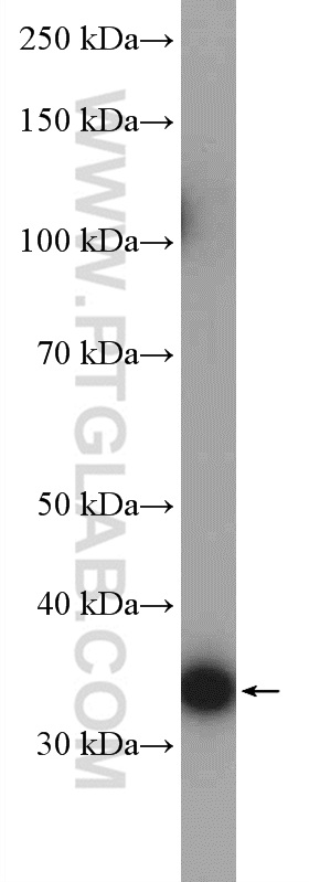 WB analysis of U2OS using 14186-1-AP