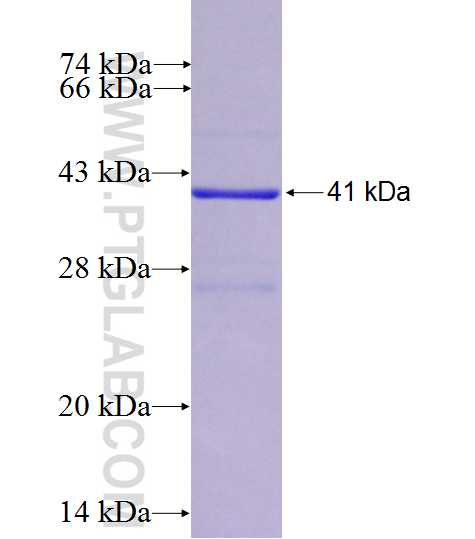 UQCC fusion protein Ag27123 SDS-PAGE