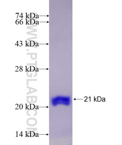 UQCC fusion protein Ag27194 SDS-PAGE