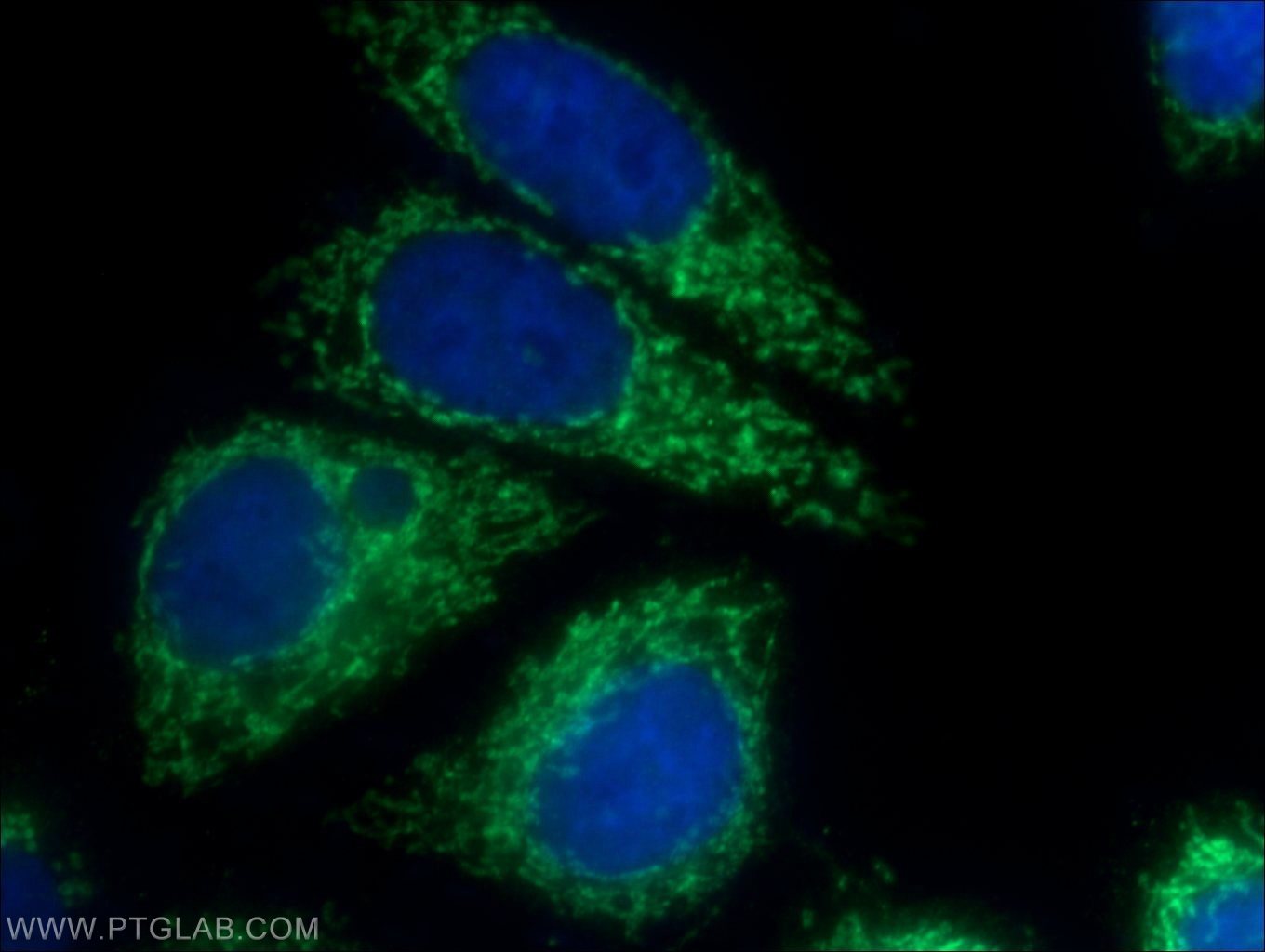 IF Staining of HepG2 using 25781-1-AP