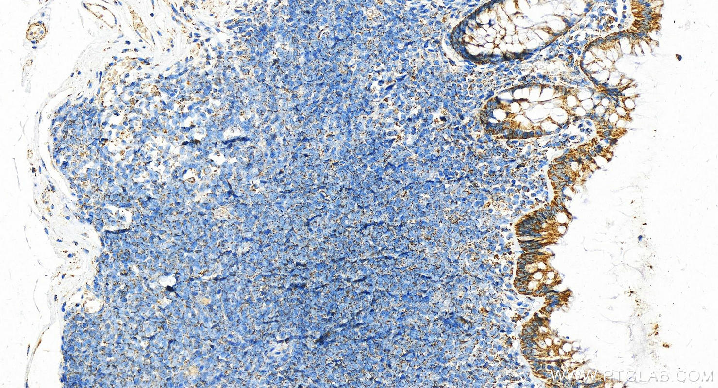 IHC staining of human colon using 21705-1-AP