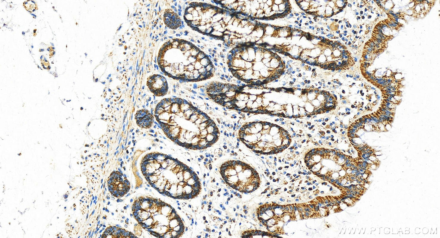 IHC staining of human colon using 21705-1-AP