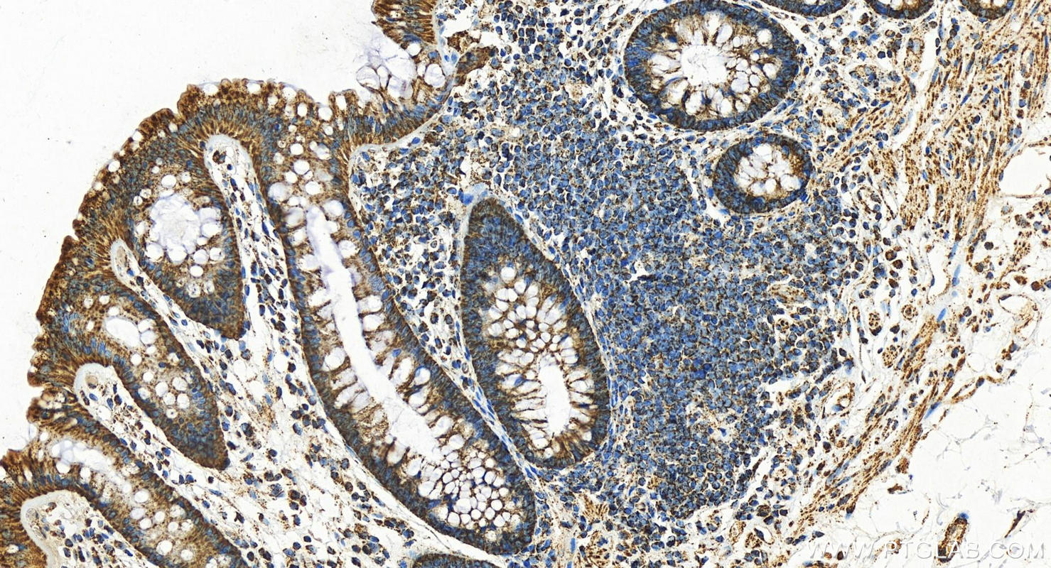 IHC staining of human normal colon using 14742-1-AP