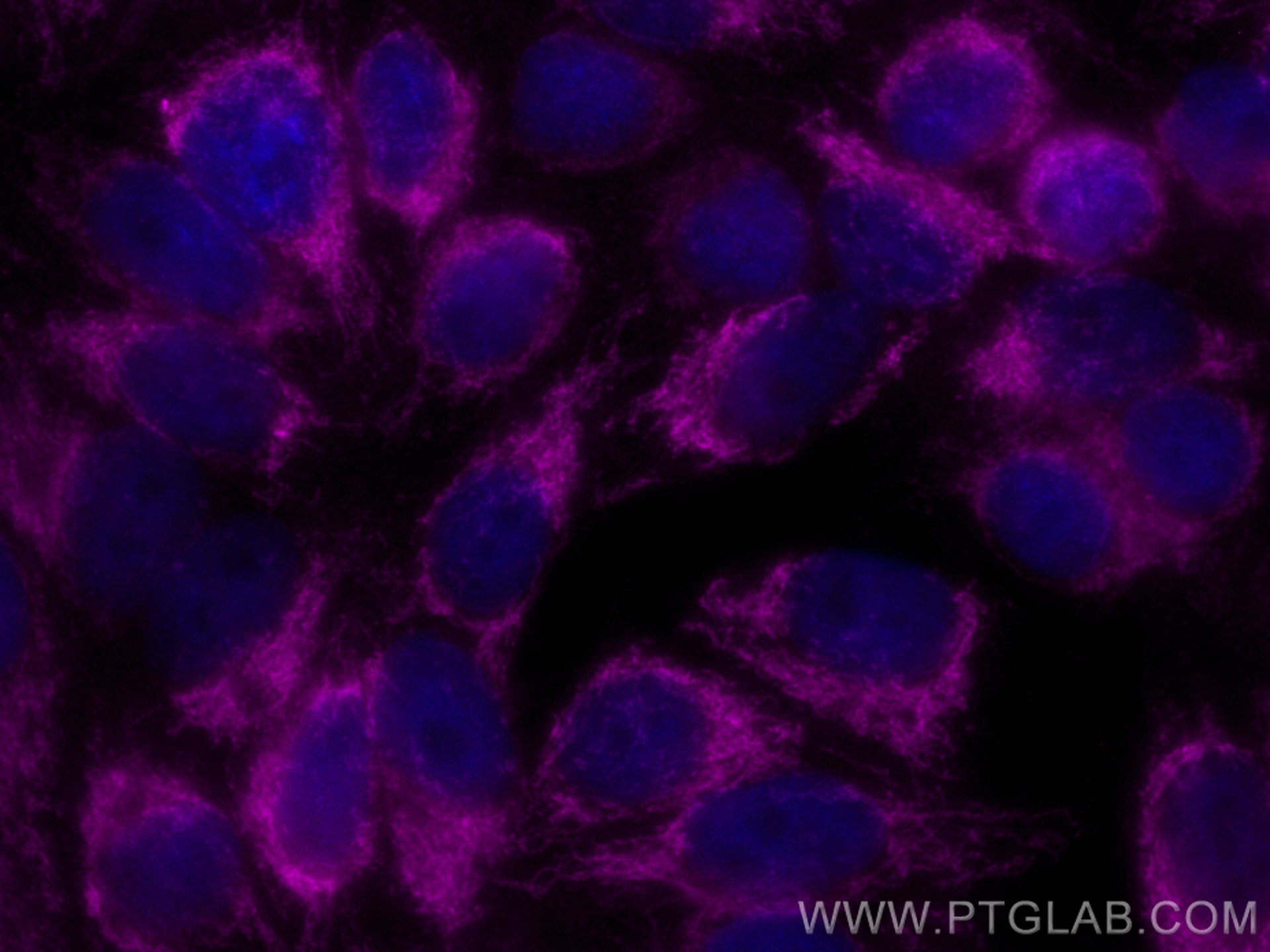 IF Staining of HepG2 using CL647-14742