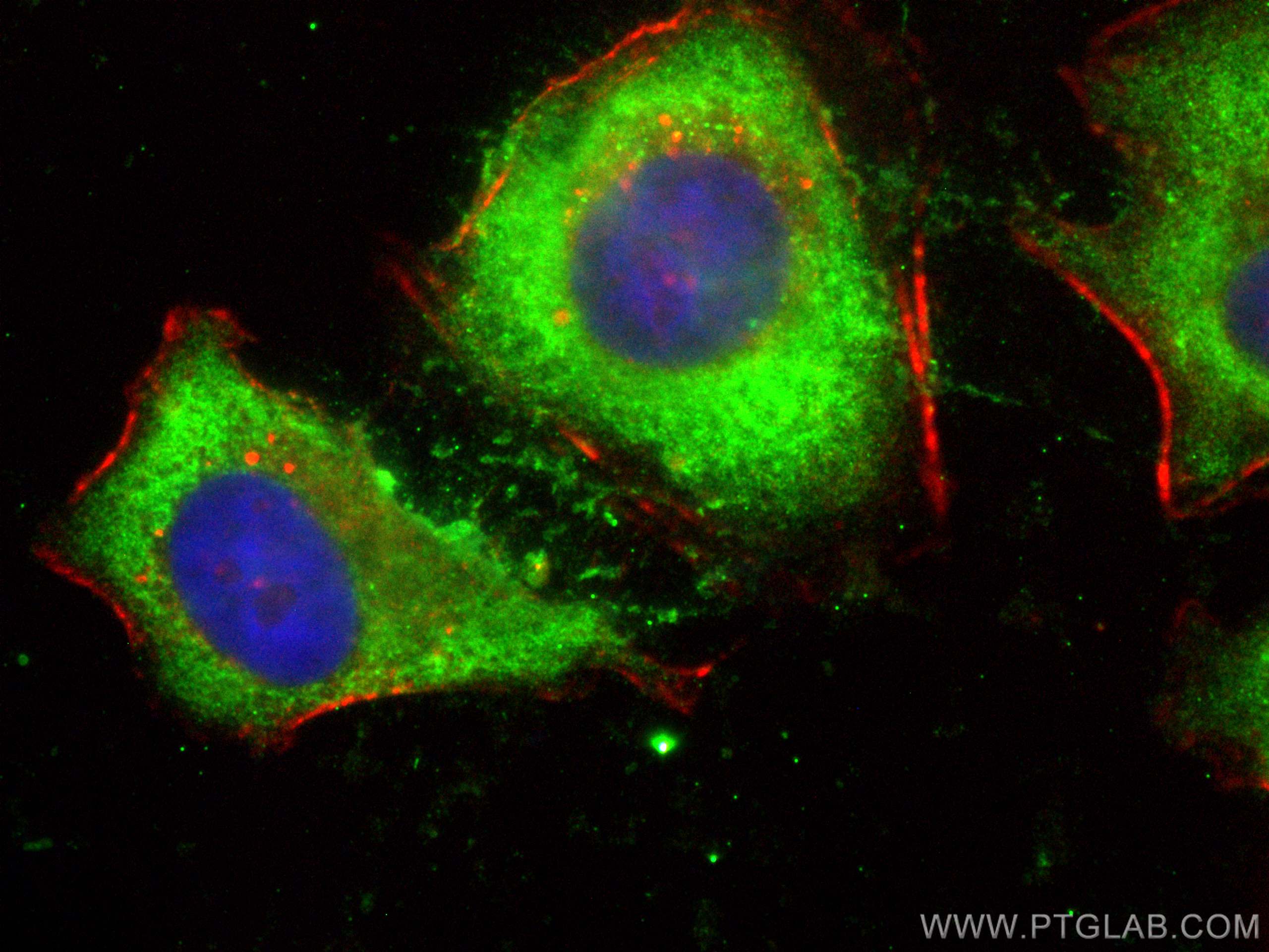 IF Staining of HeLa using CL488-11998