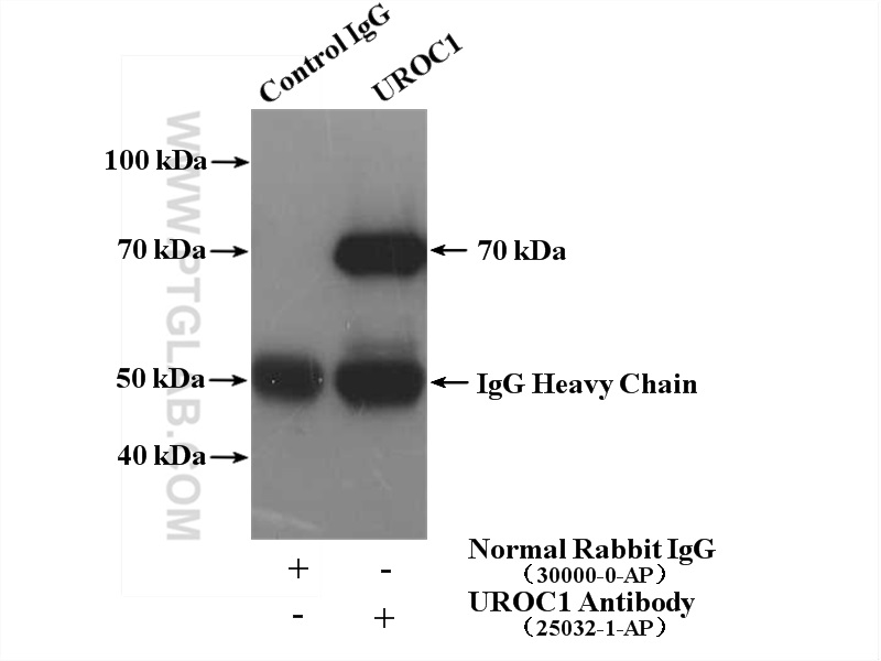 IP experiment of mouse liver using 25032-1-AP