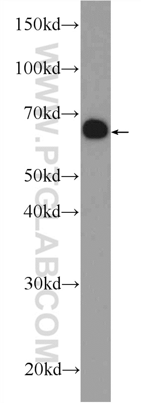 WB analysis of mouse liver using 25032-1-AP