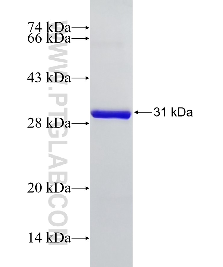 USE1 fusion protein Ag18597 SDS-PAGE