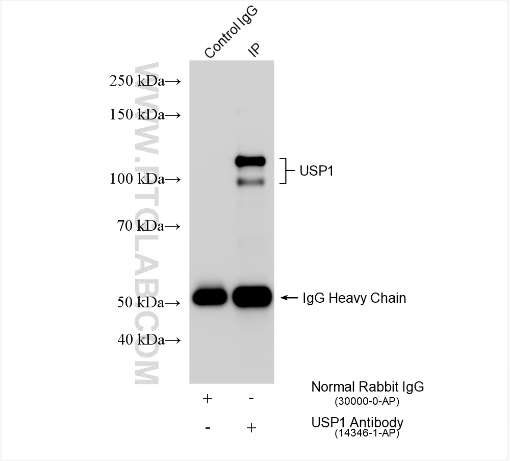 IP experiment of HEK-293 using 14346-1-AP