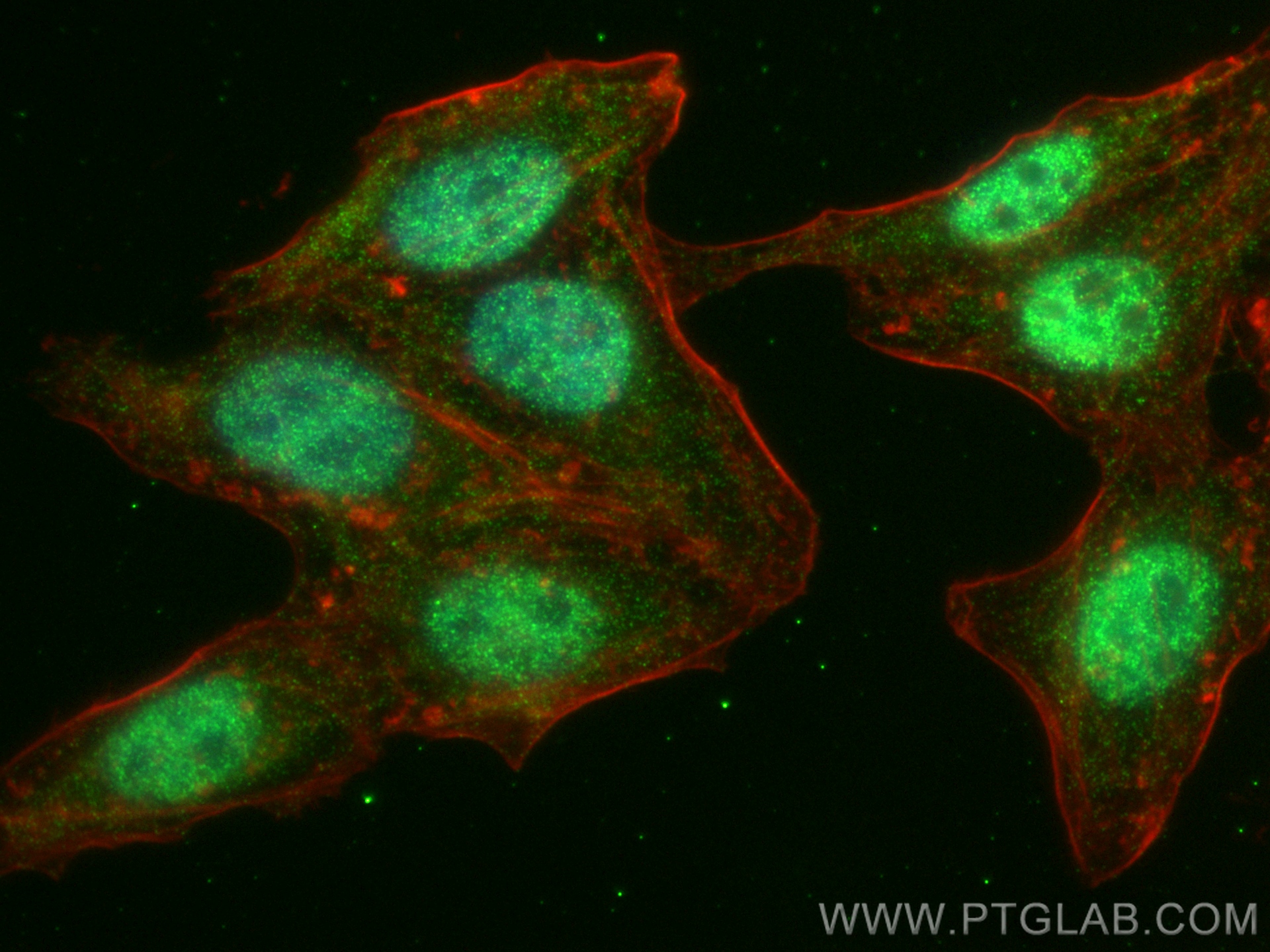 IF Staining of HepG2 using 81435-2-RR (same clone as 81435-2-PBS)