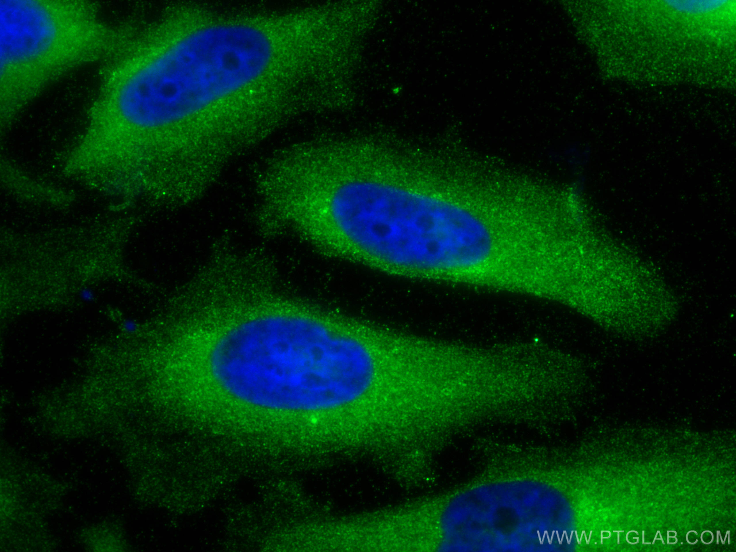 IF Staining of HeLa using 16840-1-AP